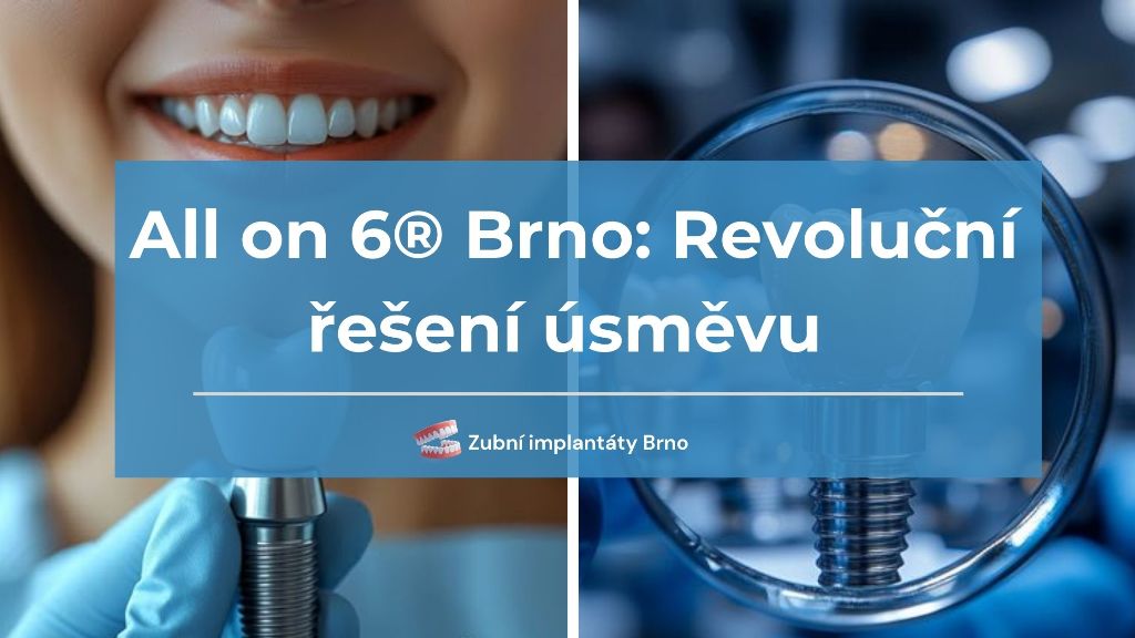 All on 6® Brno: Revoluční řešení pro dokonalý úsměv