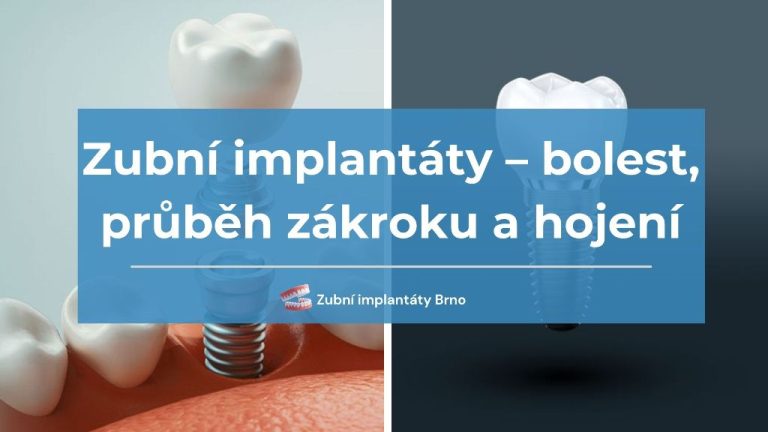 Zubní implantáty – bolest, průběh zákroku a hojení